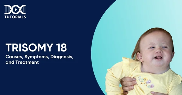 Trisomy 18