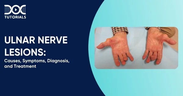 Ulnar Nerve