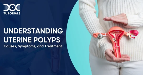 Uterine Polyps
