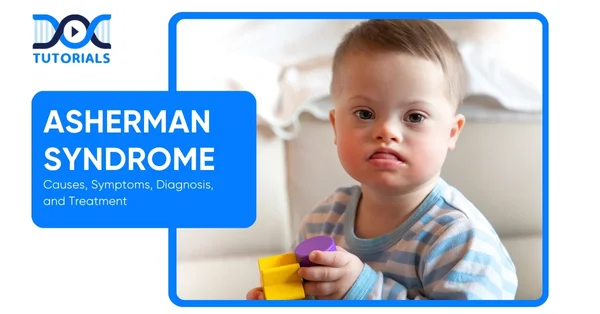 Asherman Syndrome
