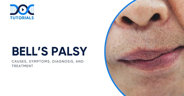 Bell’s Palsy