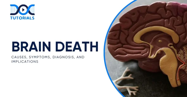 Brain Death