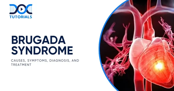 Brugada Syndrome