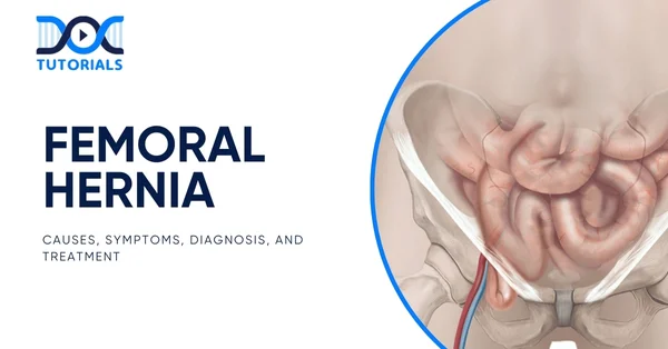 Femoral Hernia