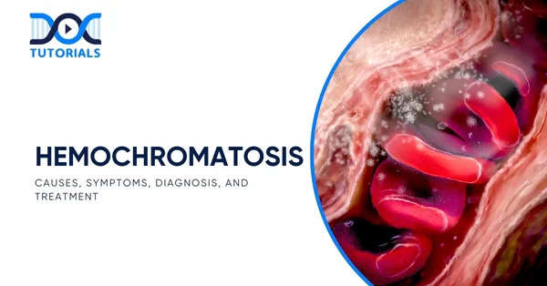 Hemochromatosis