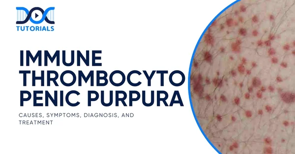 Immune Thrombocyto Penic Purpura