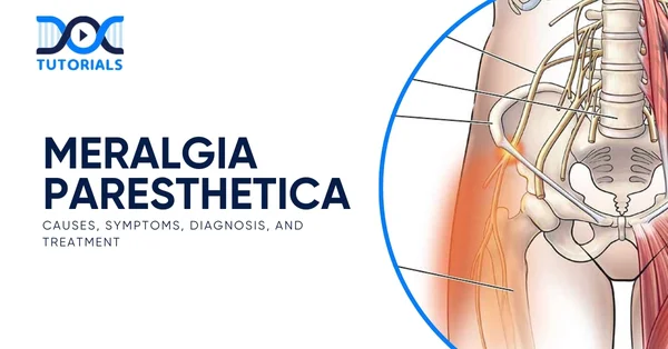 Meralgia Paresthetica