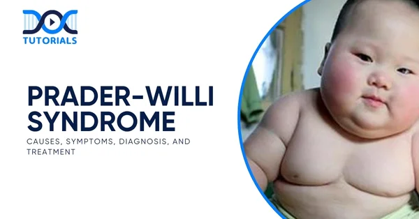 Prader-Willi Syndrome