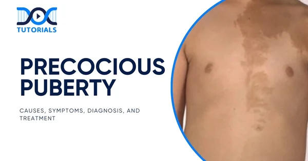Precocious Puberty