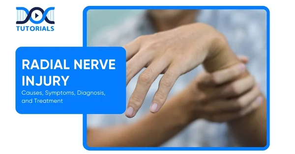 Radial Nerve Injury