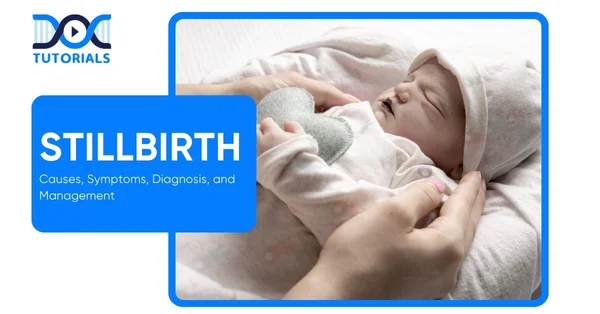 Stillbirth