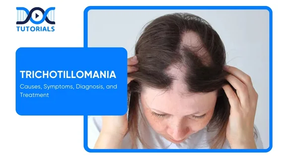 Trichotillomania
