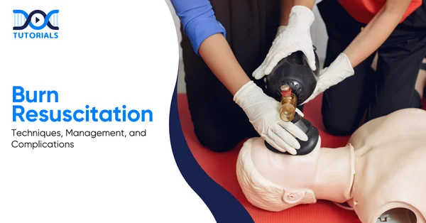 Burn Resuscitation | DocTutorials