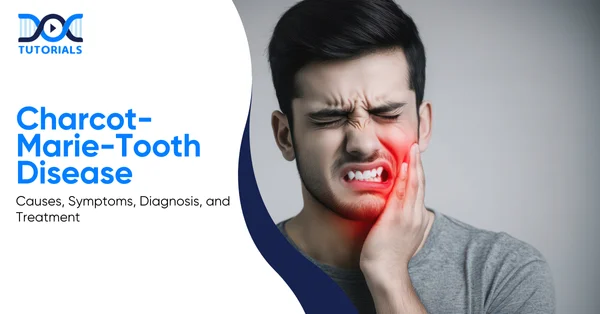 Charcot-Marie-Tooth Disease | DocTutorials