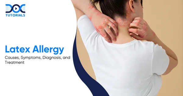 Latex Allergy | DocTutorials