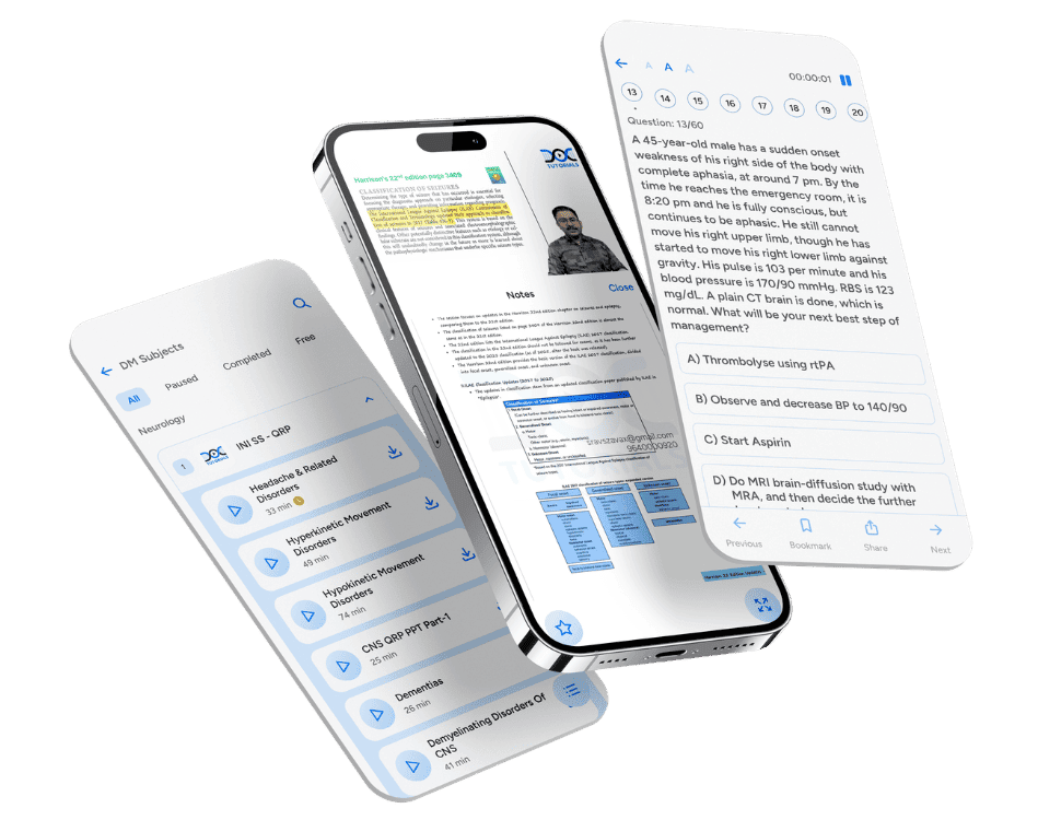 INI SS DM Preparation