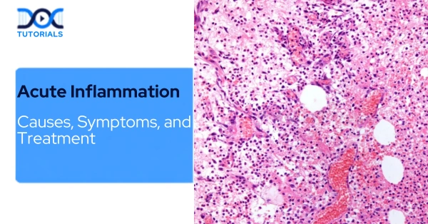 Acute-Inflammation
