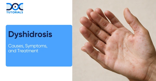 Dyshidrosis Causes, Symptoms, and Treatment
