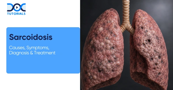 sarcoidosis.