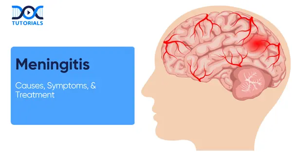 Meningitis