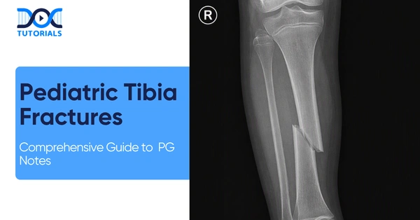 Pediatric Tibia Fractures