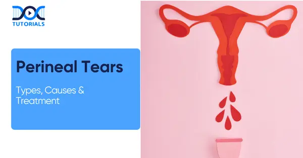 Perineal Tears