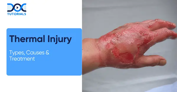 Thermal injury types and cause