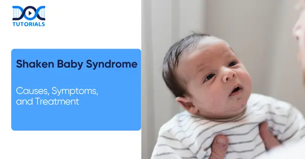 Shaken Baby Syndrome